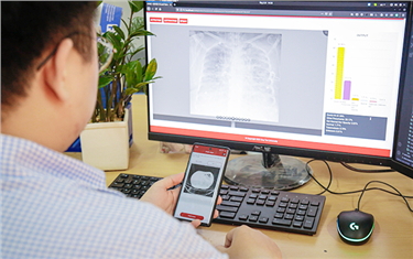 DTU Develops X-Ray and CT App for Covid-19 Detection